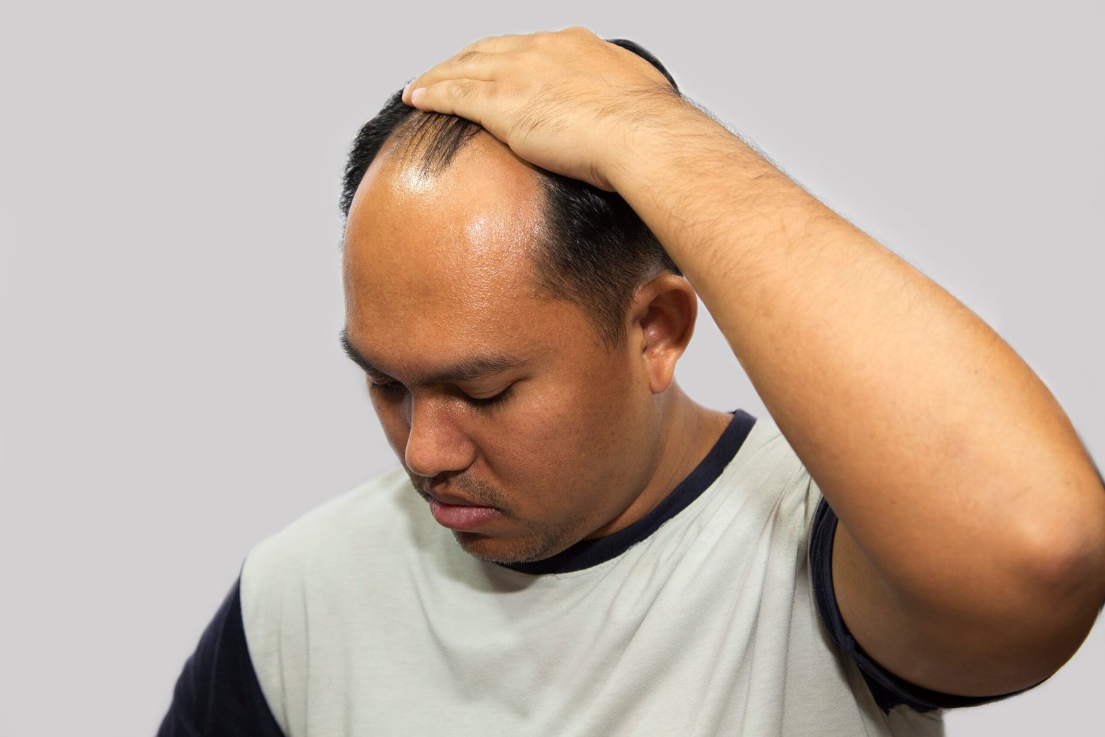 Read more about the article 8 common Hair Growth Problems in Men and Women