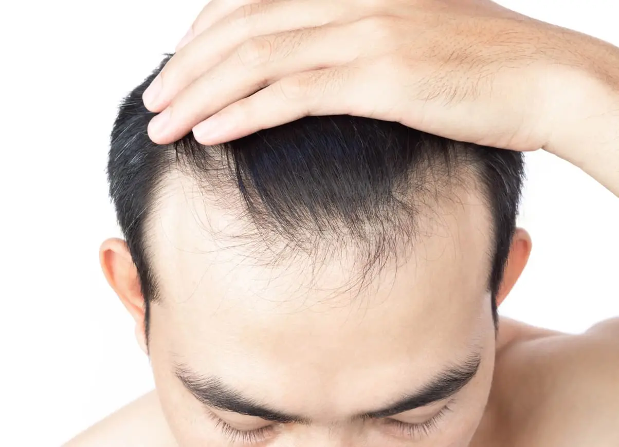 Read more about the article Connection Between a Healthy Scalp and Hair Growth: 6 Solution
